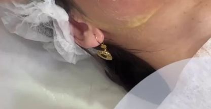 کلینیک زیبایی هیلدا