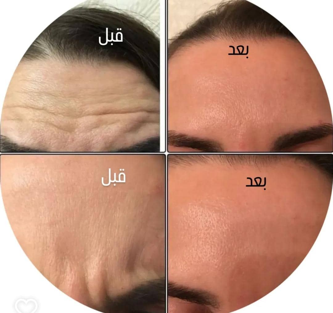 کلینیک زیبایی راشا