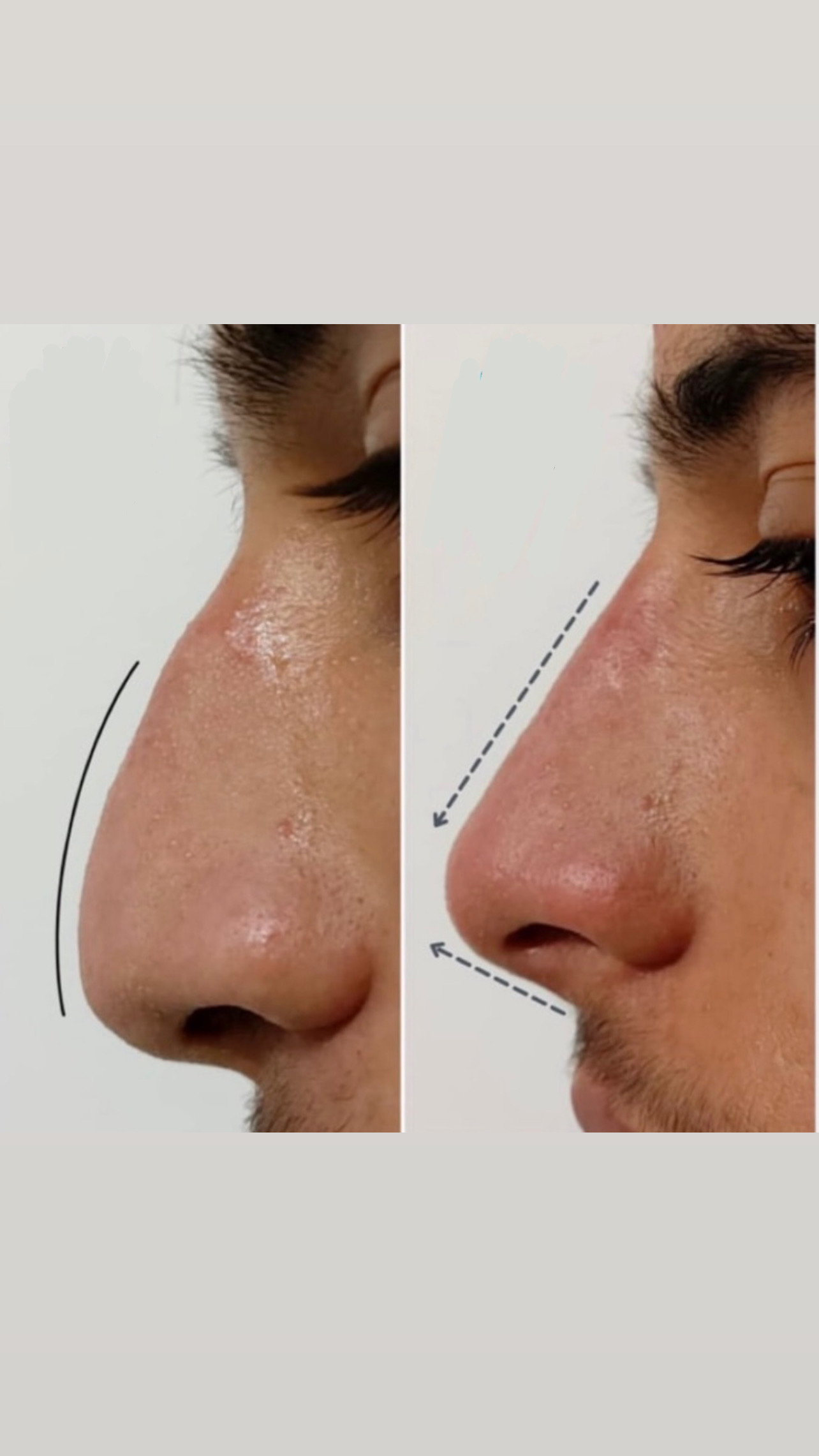 کلینیک ژل بوتاکس لیزر فیل بیوتی