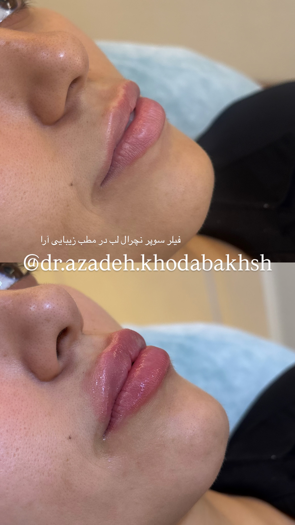 مطب زیبایی آرا