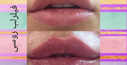 کلینیک پوست و مو نیک آفرید