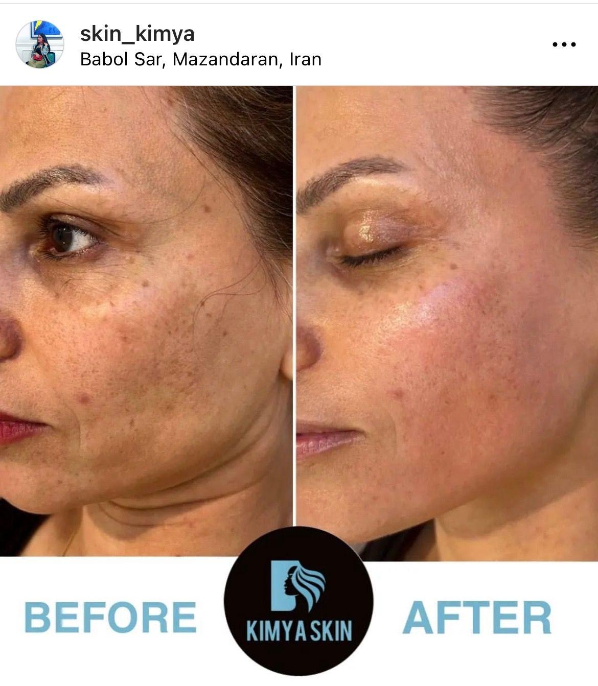 مرکز پاکسازی پوست کیمیا اسکین