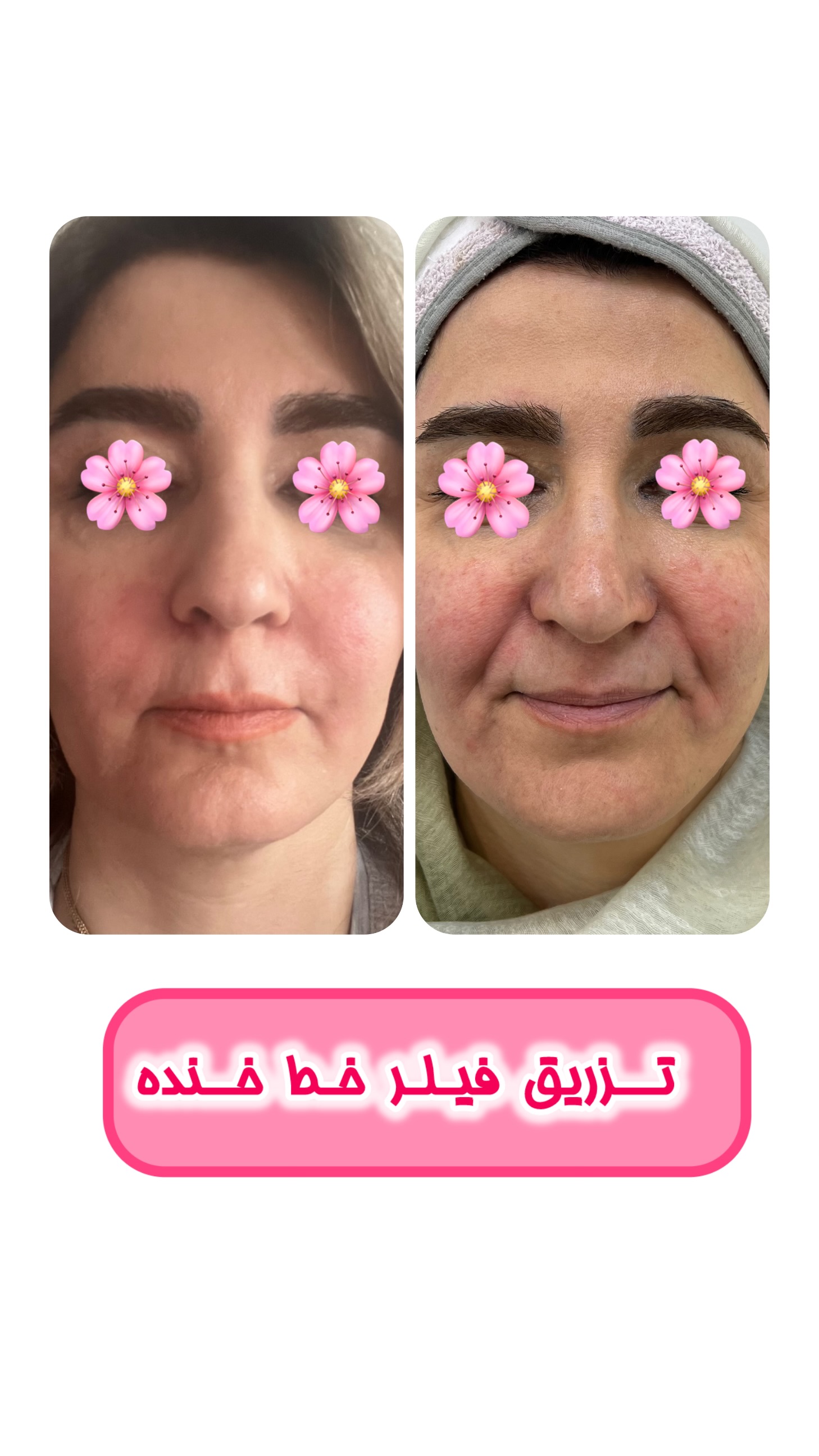 کلینیک پوست،مو و لیزر هانا