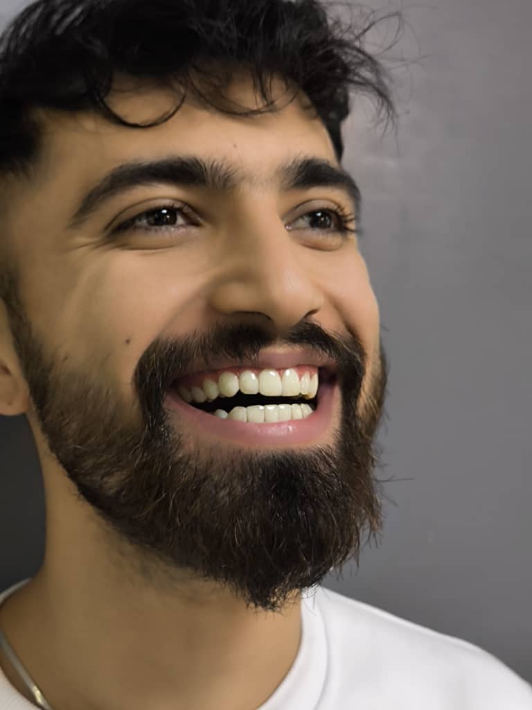 کامپوزیت ونیر