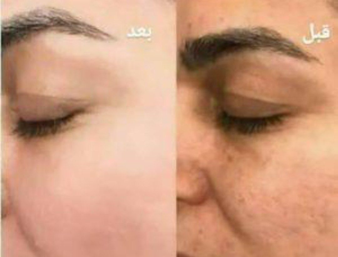 فروش لوازم آرایشی تراست (مونا)