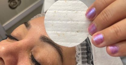 پاكسازي پوست احمدیان