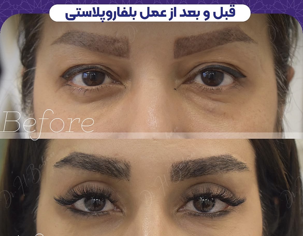 دکتر محمود قهقایی فوق تخصص جراحی پلاستیک