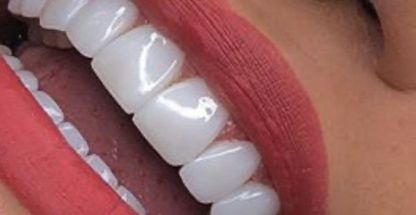 کلینیک دندانپزشکی وایت دنتال