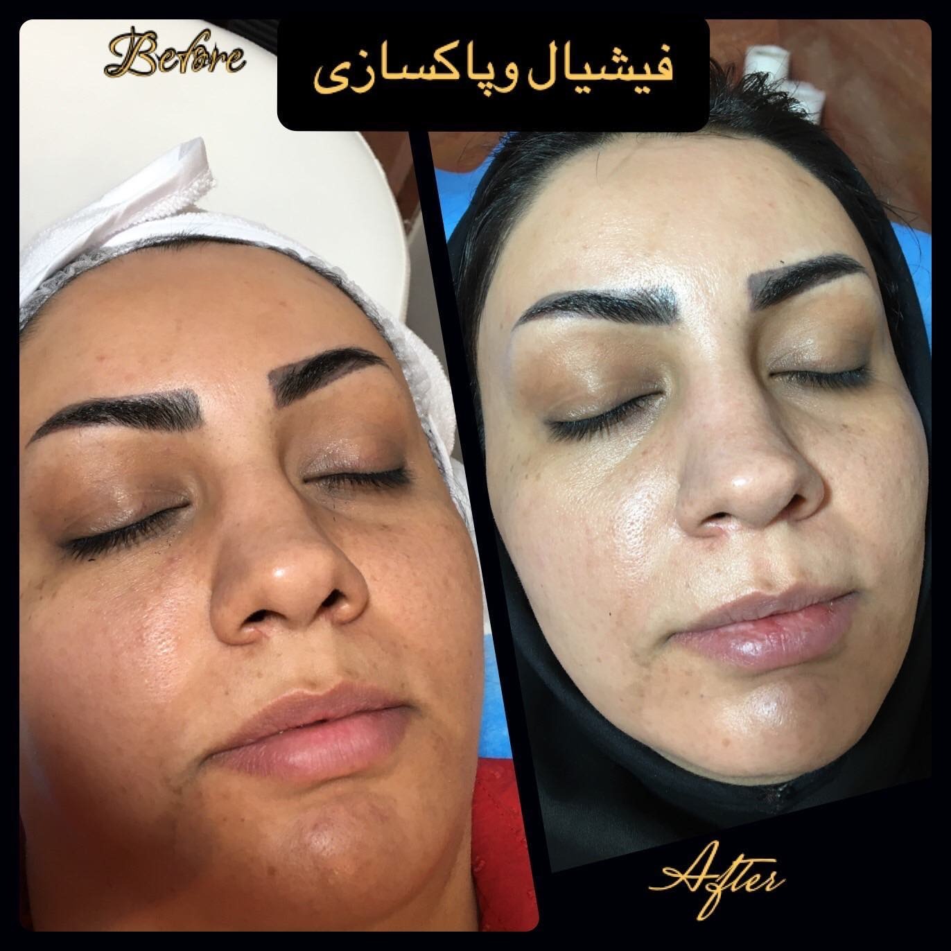 کلنیک تخصصی پوست مو لیزر جراحی رز