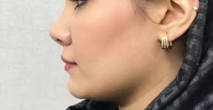 کلینیک لیزر و زیبایی مهرُنا