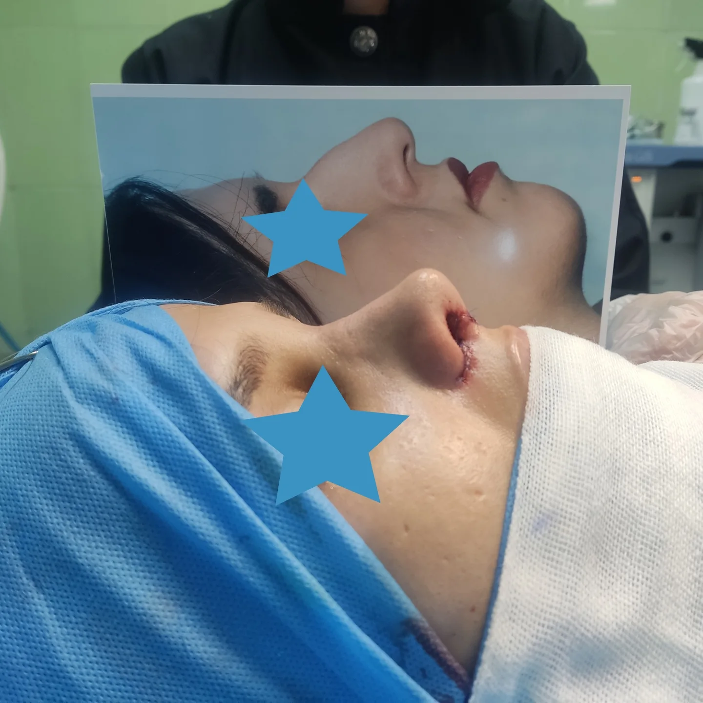 جراح بینی دکتر مسعود ملکی