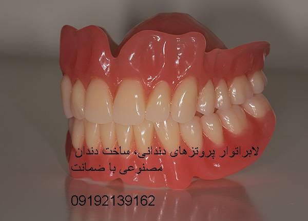 لابراتوار دندانسازی دندان مصنوعی ژله ای نایت گارد دندان سازی ایمپلنت نایتگارد