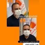 کلینیک کاشت مو خانه سفید