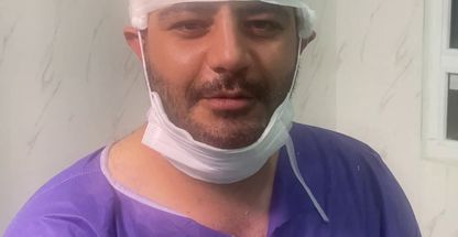 کلینیک کاشت مو و ابرو آزاد رستمی