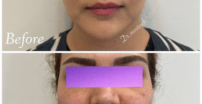 کلینیک تخصصی پوست و کاشت مو سحر