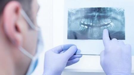 رادیولوژی تخصصی فک و صورت پرهام پرتو