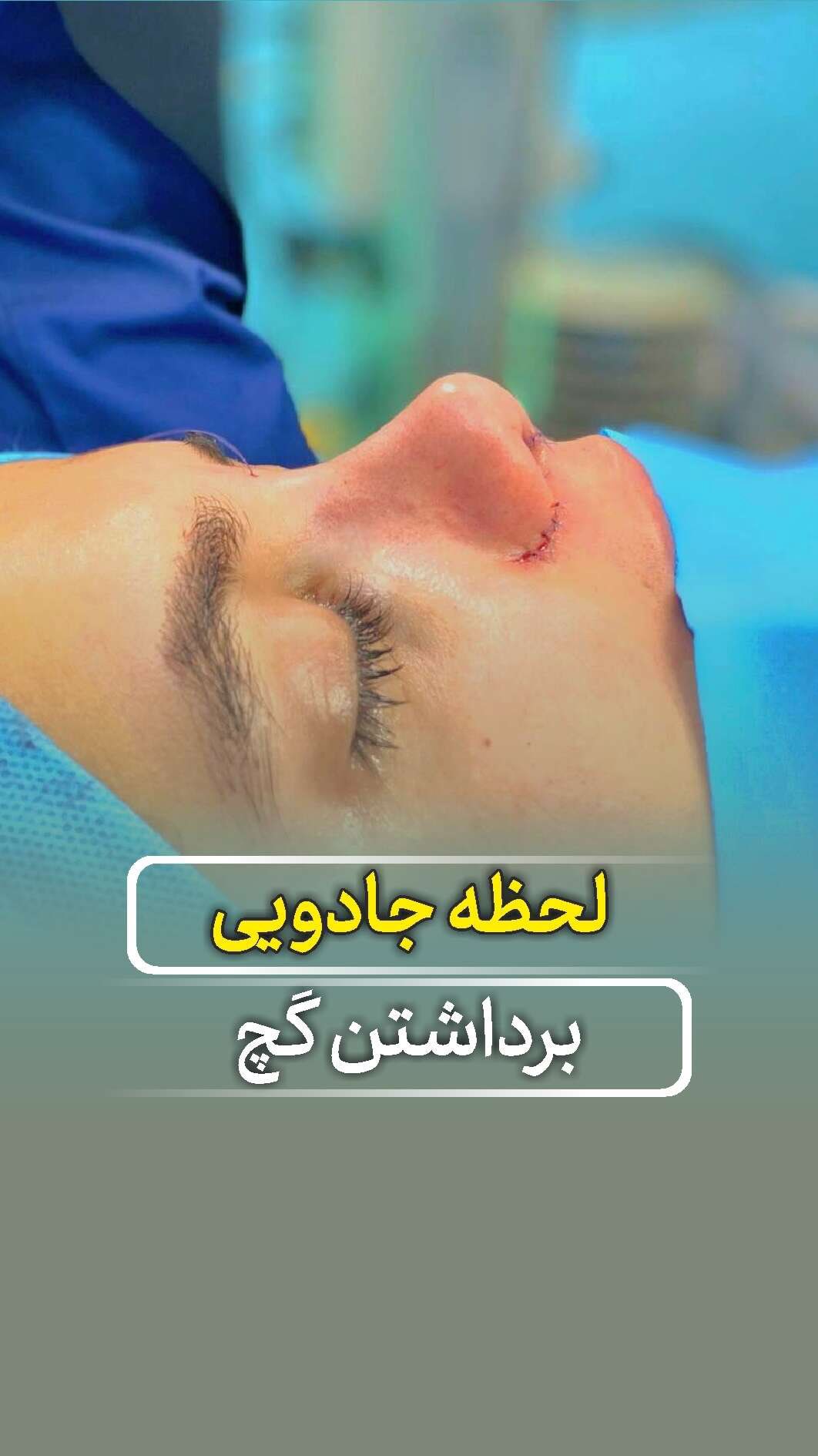 دکتر عارفه هدایتی جراح بینی