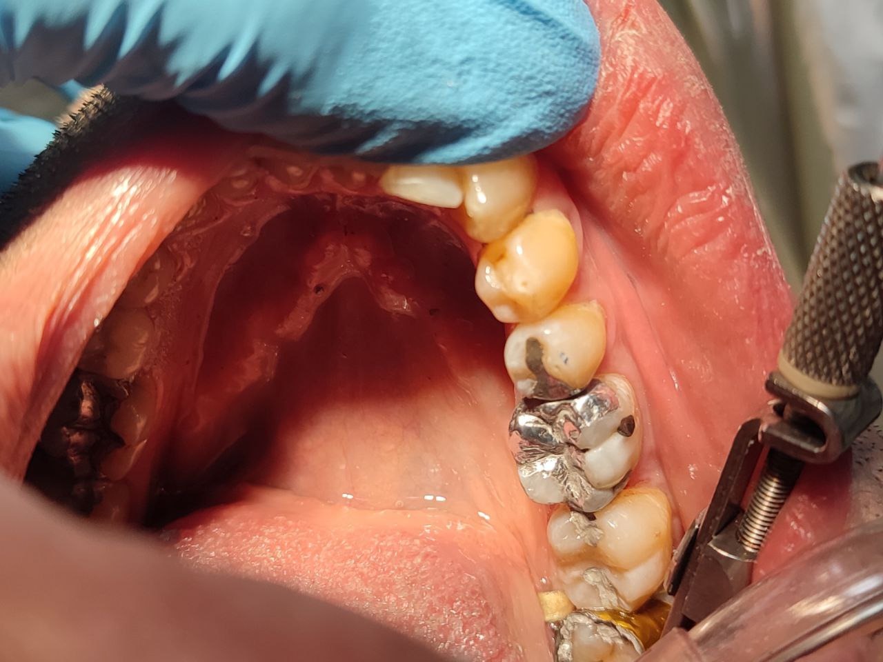 مطب دندانپزشکی سورنا (دکتر سروش هاشمی)