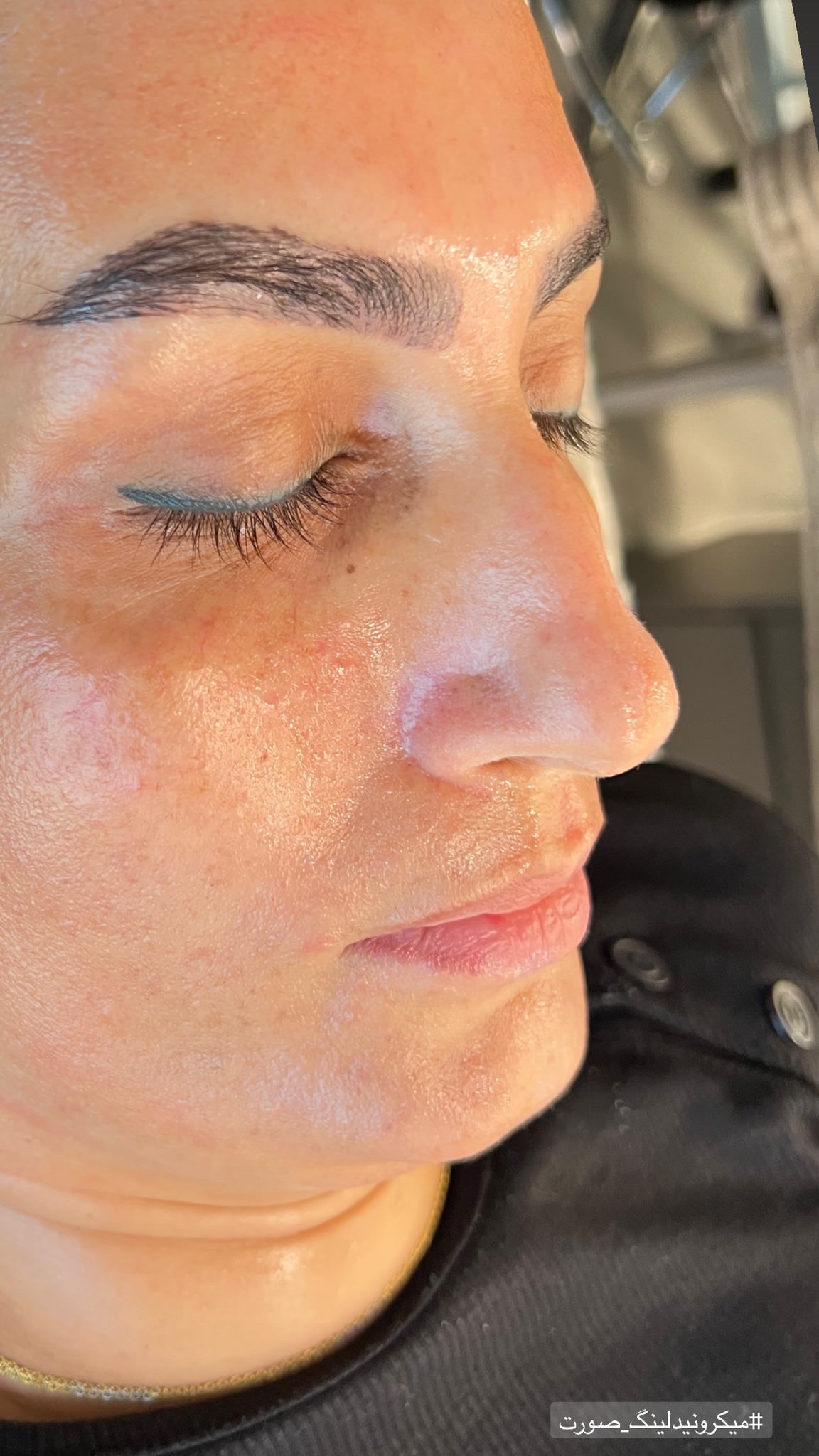 کلینیک لاغری و فیشال