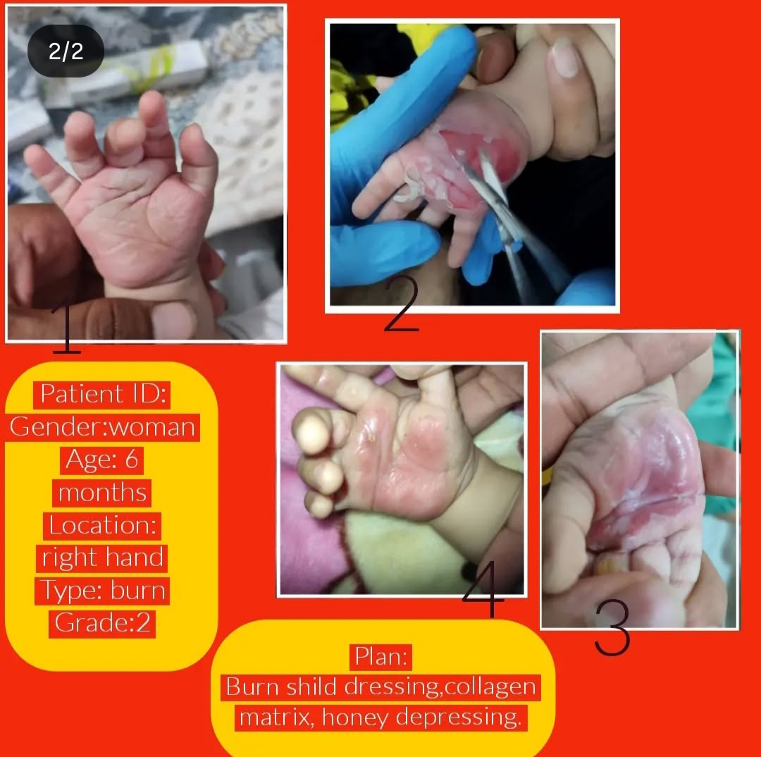 کلینیک زخم شکیبی