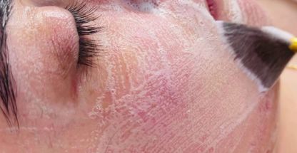 فیشیال پوست با سحر