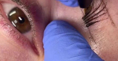 میکروبلیدینگ ابرو هلیا