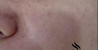 پاکسازی پوست اکرم رامشینی