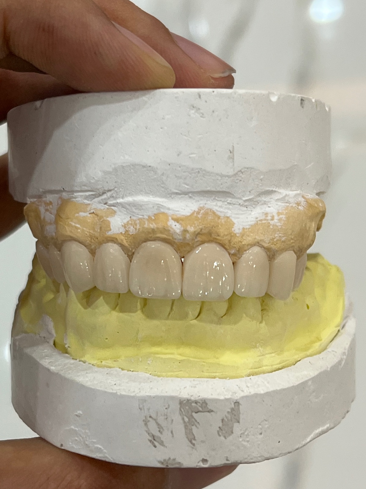 لابراتوار دندانسازی تاج