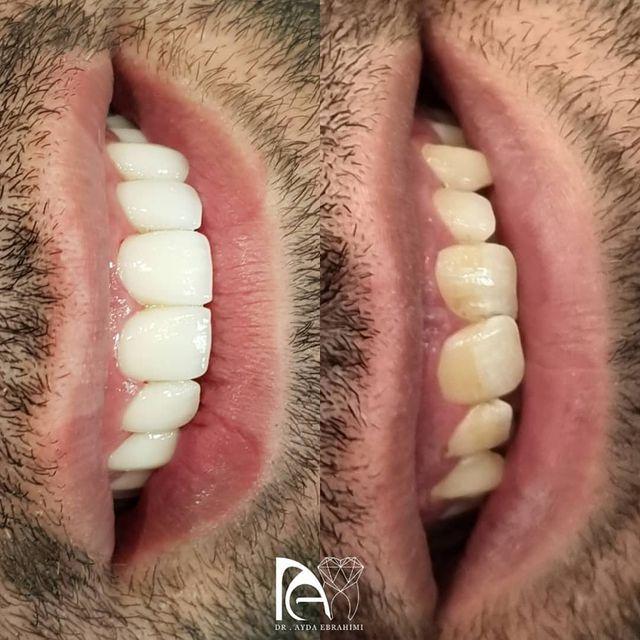 مرکز دندانپزشکی دکتر آیدا ابراهیمی
