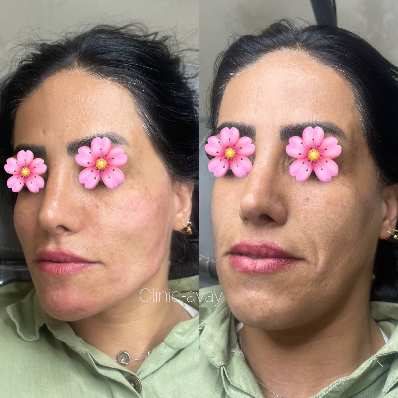 کلینیک زیبایی آوا