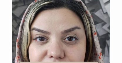 مرکز لیزر و کلینیک زیبایی سینوهه