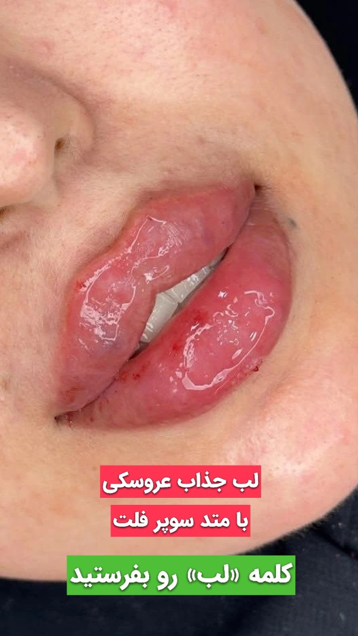 کلینیک زیبایی شایلی
