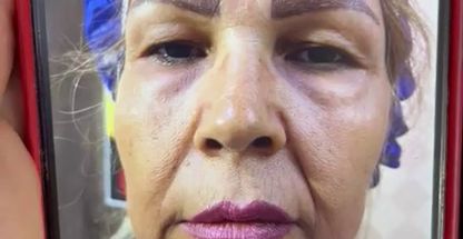 مرکز زیبایی جراحی ابریشم بیوتی شهرقدس