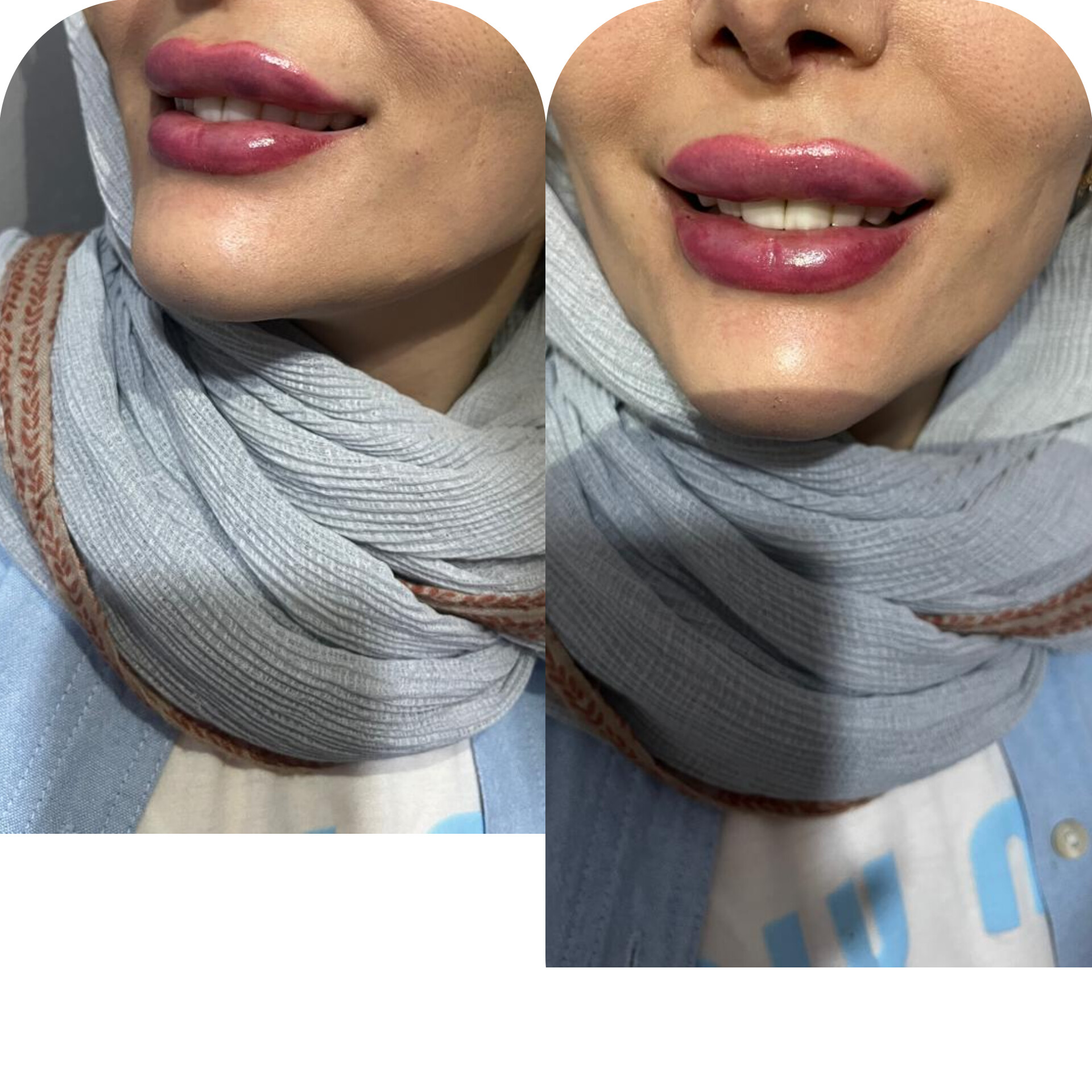 خدمات ژل و بوتاکس دکتر صالحی