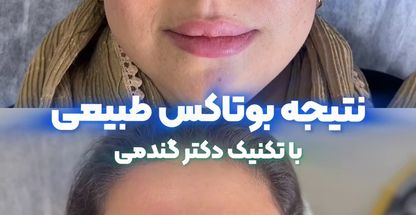 کلینیک زیبایی و لیزر دکتر میلاد گندمی