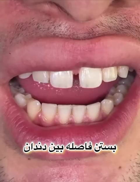 دندانپزشکی دکتر مصطفی محمدی-بیمه نداریم