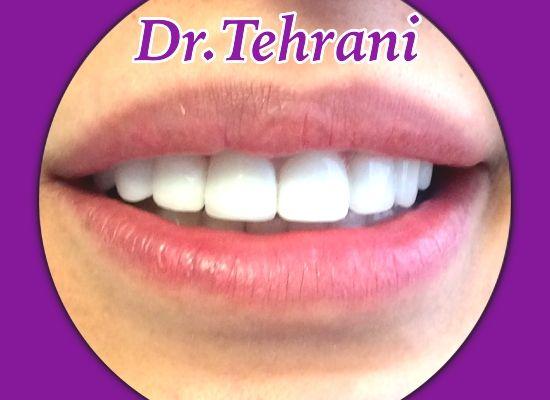 دکتر منیره سادات تهرانی