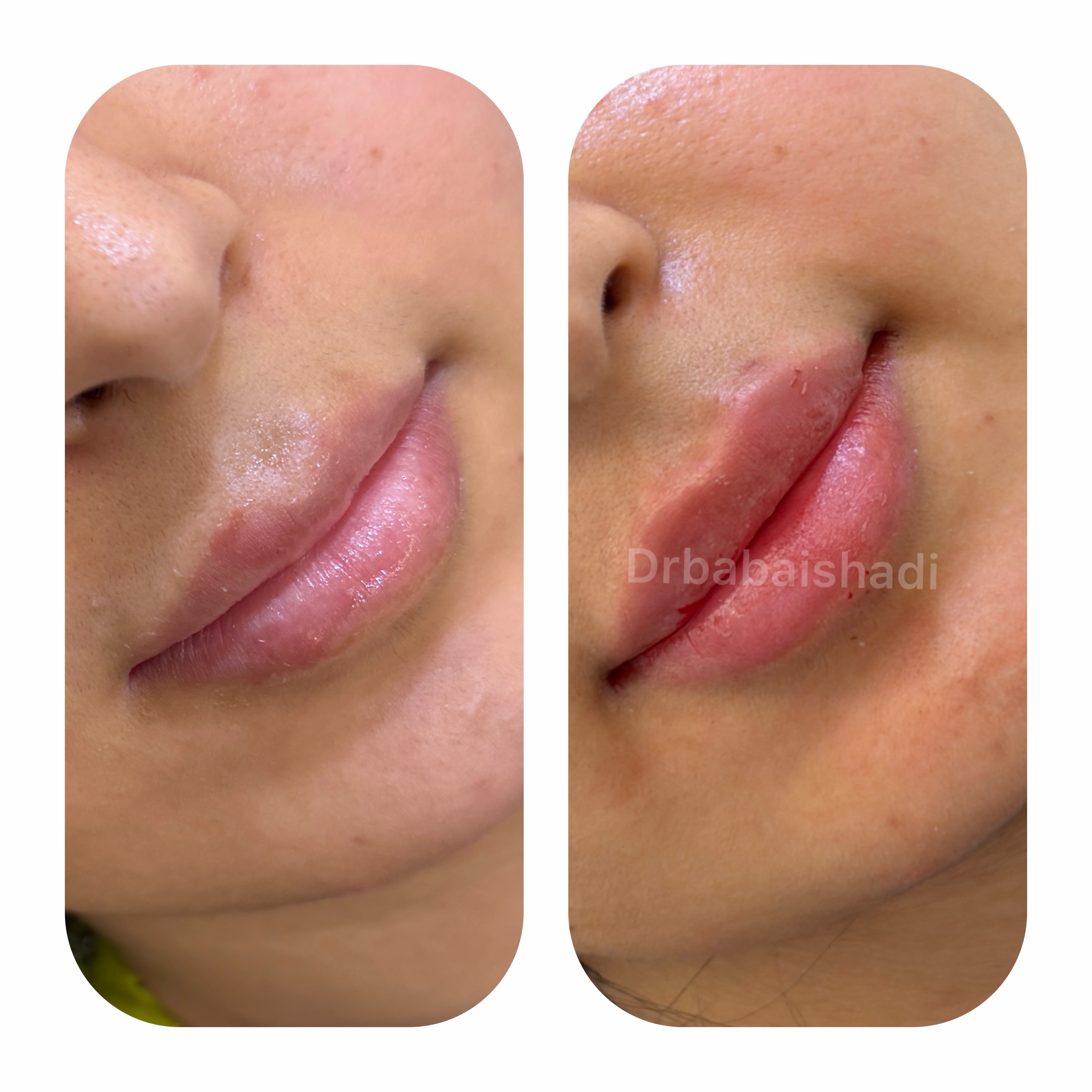 کلینیک تخصصی ژل و بوتاکس مرضیه آقابابایی
