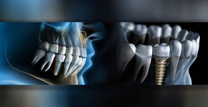 کلینیک تخصصی دندانپزشکی رویال وان