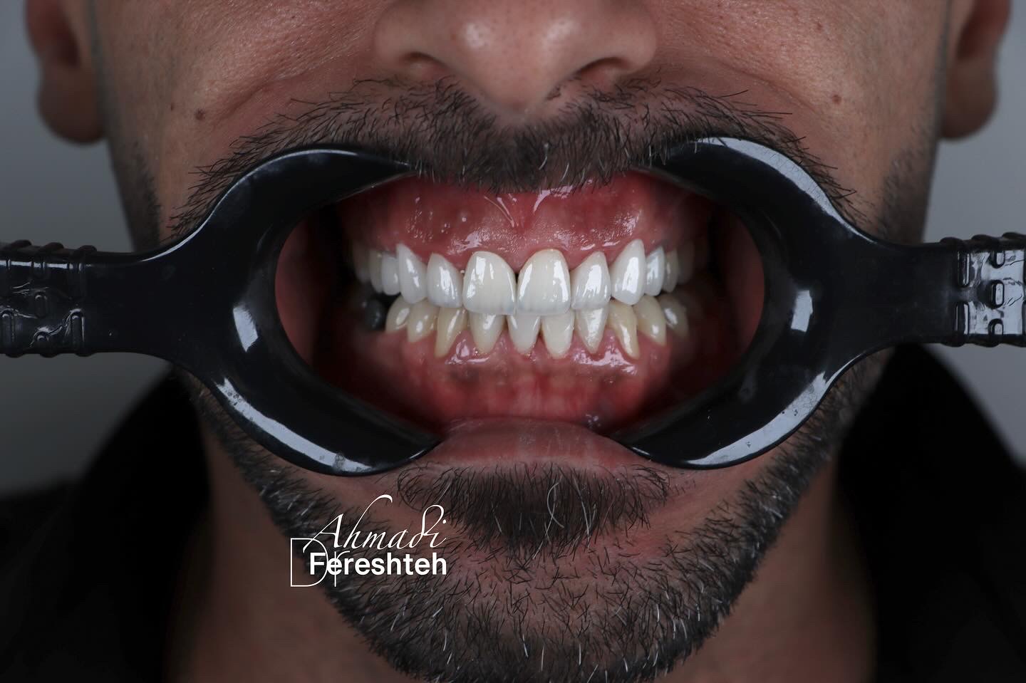 دکتر فرشته احمدی دندانپزشک(بیمه نداریم)