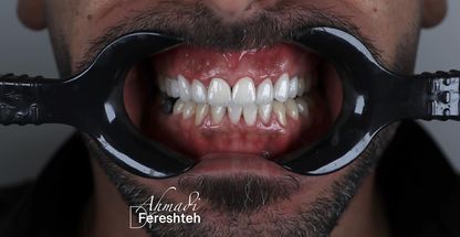 دکتر فرشته احمدی دندانپزشک(بیمه نداریم)