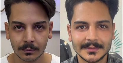 کلینیک زیبایی پوست مو لیزر آینا