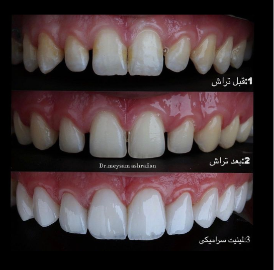 دکتر میثم اشرفیان