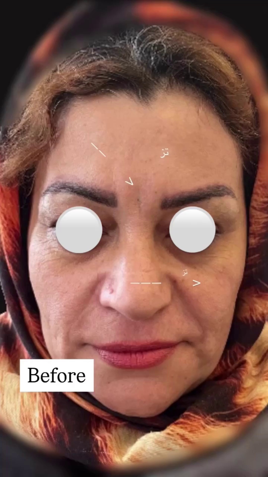 کلینیک پوست و مو دکتر زیبایی آصف