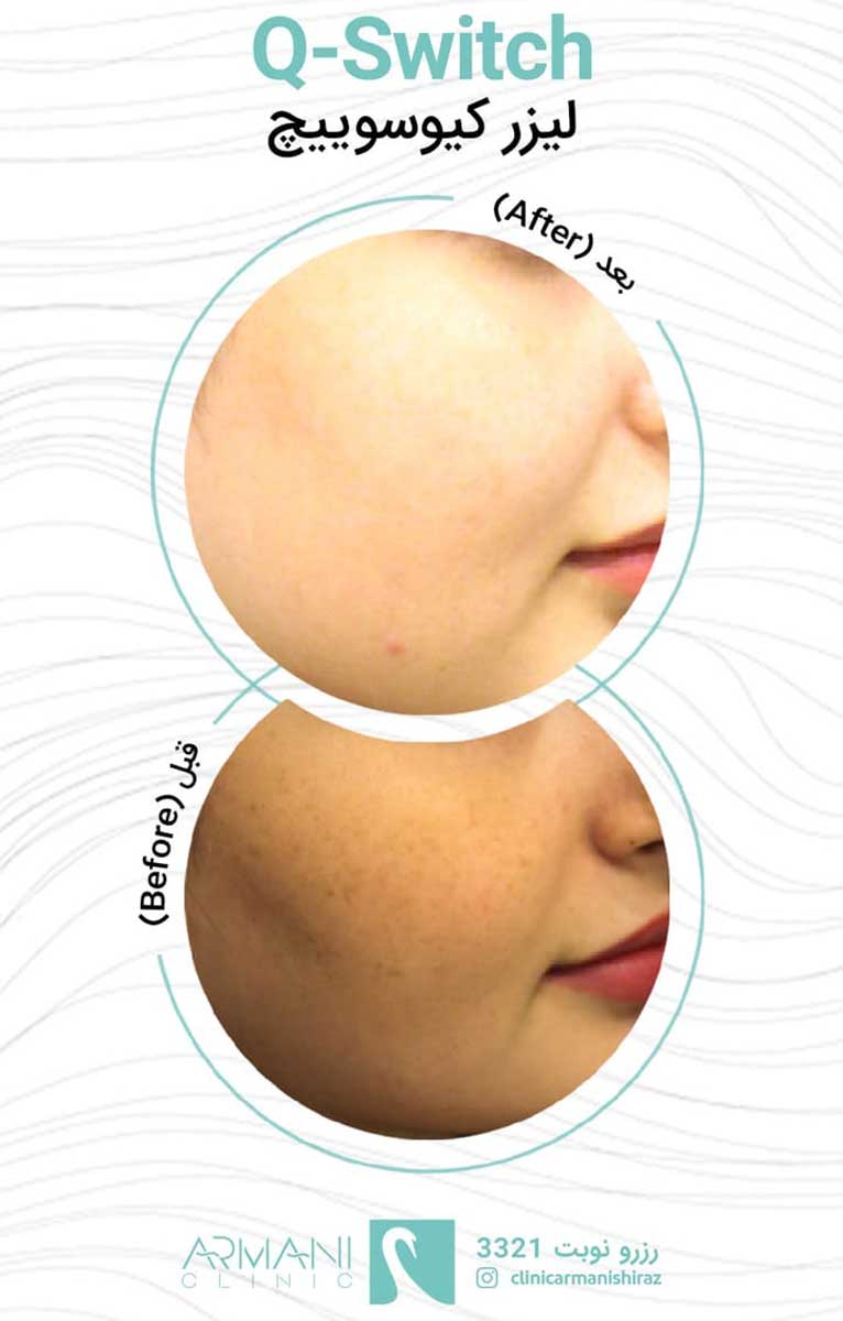 کلینیک فوق تخصصی آرمانی