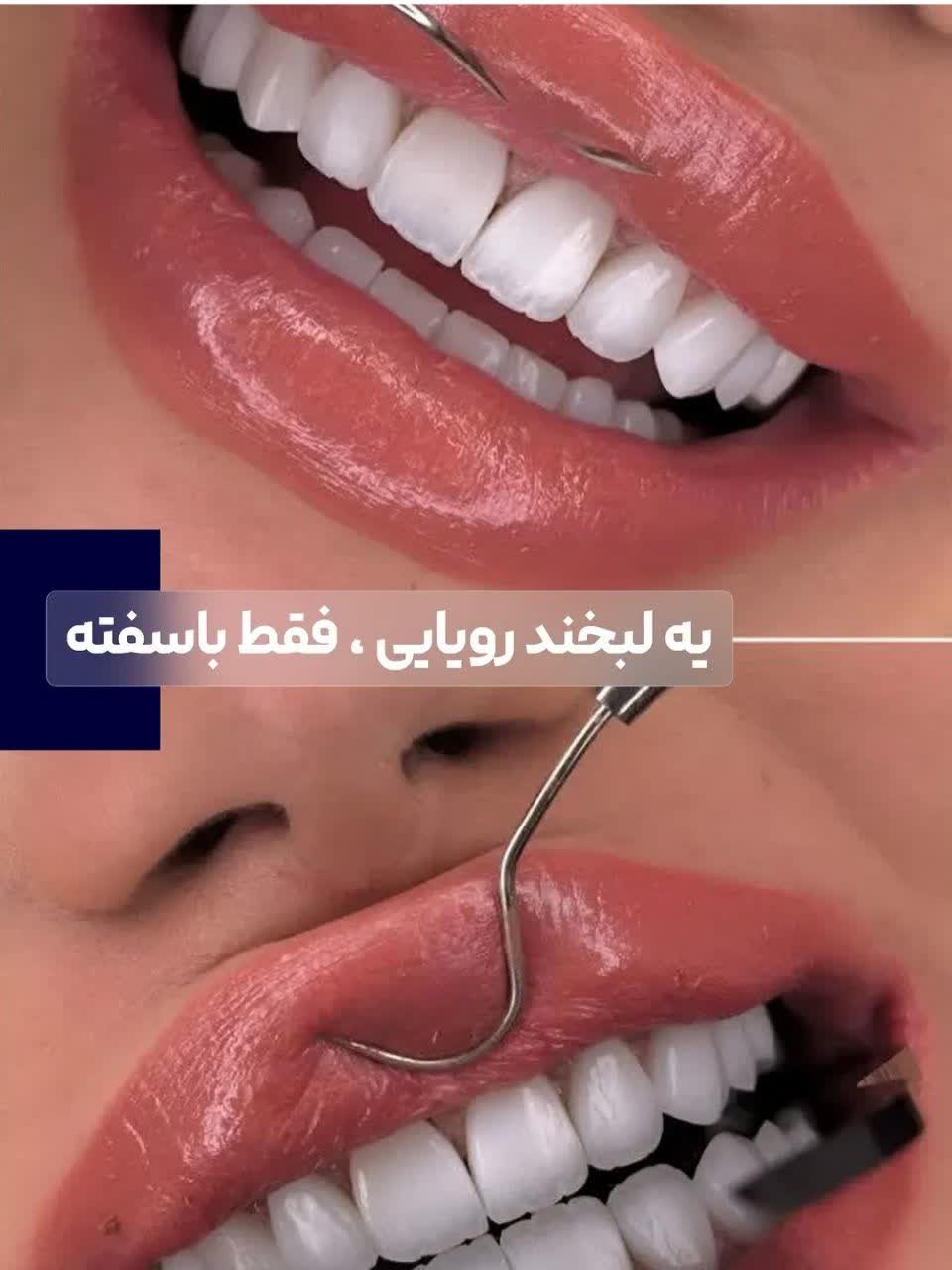 کنزودنت