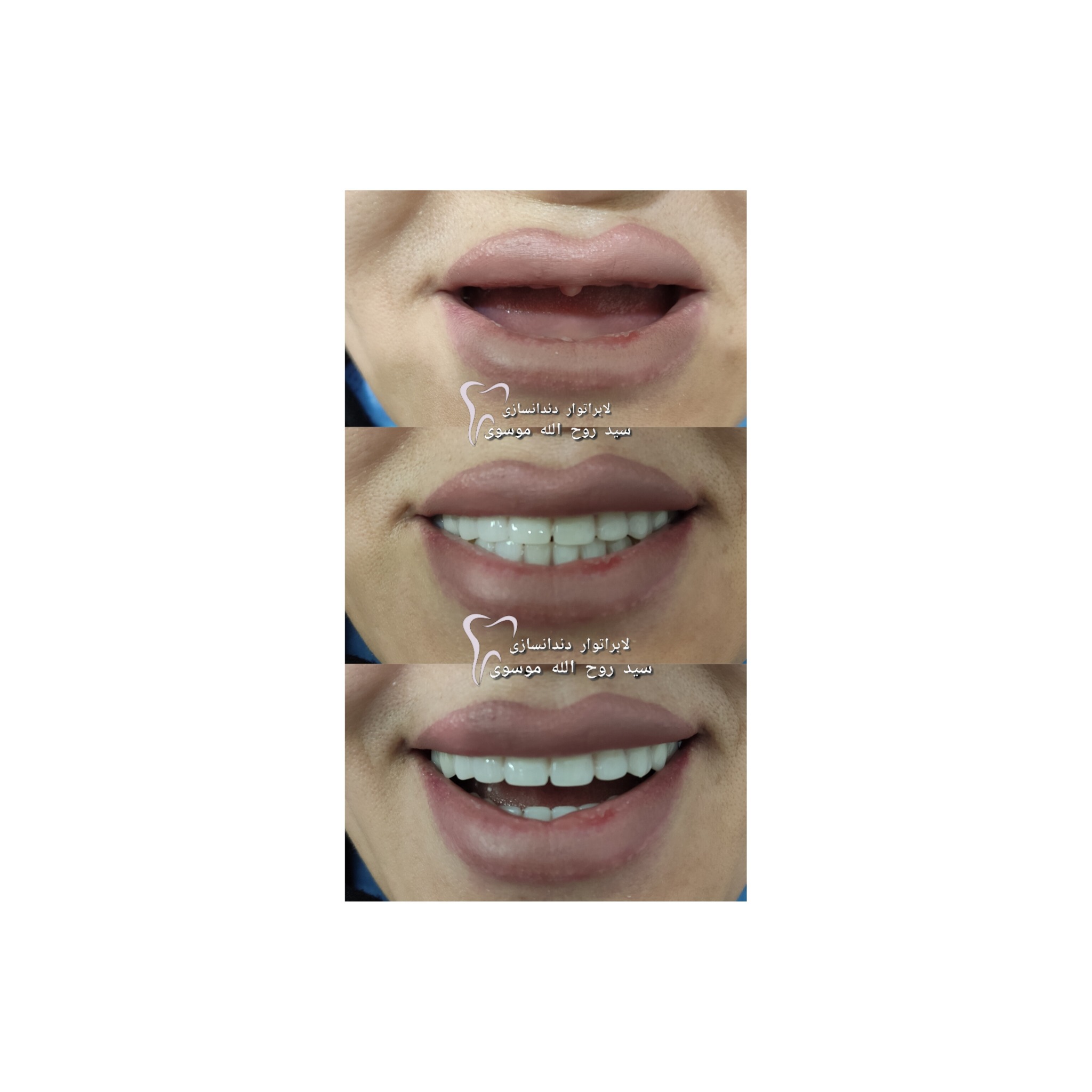 دندانسازی سیدروح الله موسوی