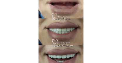 دندانسازی سیدروح الله موسوی