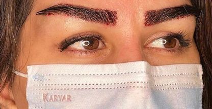 کاشت مو و ابرو دکتر فرامرزی