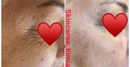 پاکسازی پوست کیمیا صدری